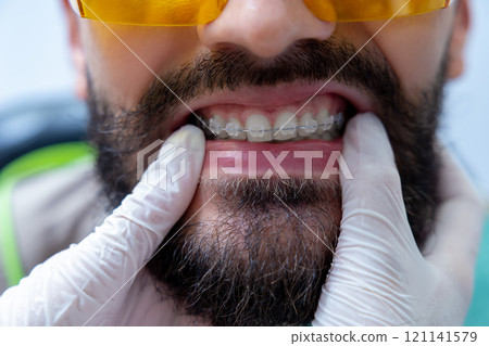Man patient during whitening teeth procedures in modern dental clinic 121141579
