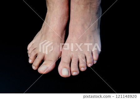 Feet of a Caucasian adult woman on black background 121148920