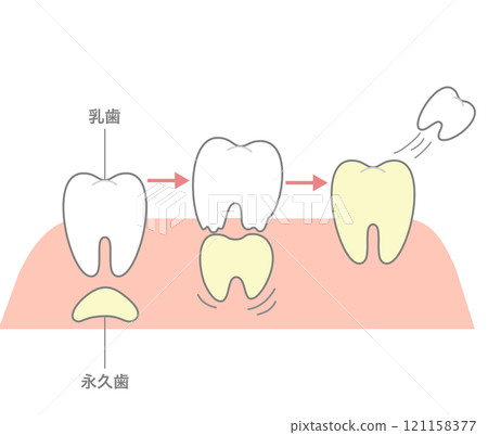Permanent teeth dissolve and push out baby teeth to replace them Permanent teeth dissolve and push out baby teeth to replace them 121158377