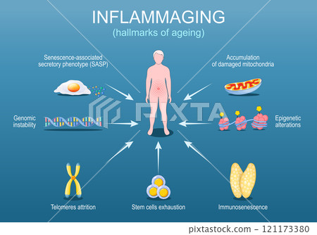 Inflammaging. Hallmarks of ageing. Chronic inflammation Inflammaging. Hallmarks of ageing. Chronic inflammation 121173380