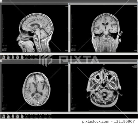 Brain dock Brain dock 121196907