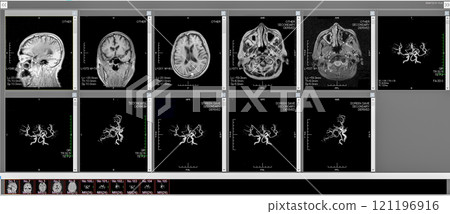 Brain dock 121196916