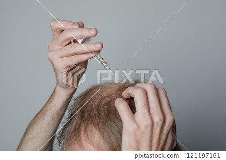 Male holding minoxidil dropper or essential oil closeup Male holding minoxidil dropper or essential oil closeup 121197161
