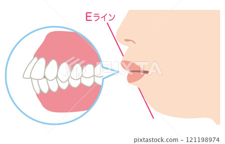 牙齒突出、E線突出、矯正 牙齒突出、E線突出、矯正 121198974
