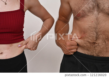 fat deposits on the abdomen of a man and a young woman. 121216020