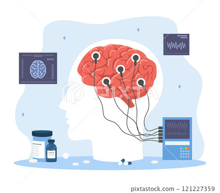 Epilepsy concept. Treatment nervous system. Electroencephalography. Brain Connected to Display with EEG Indication. Vector illustration in flat cartoon style 121227359