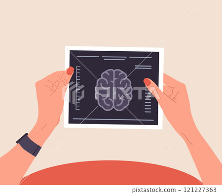 MRI scan. Female hands holding result of X-ray or MRI examination. Brain diseases concept. Vector illustration in flat cartoon style MRI scan. Female hands holding result of X-ray or MRI examination. Brain diseases concept. Vector illustration in flat cartoon style 121227363