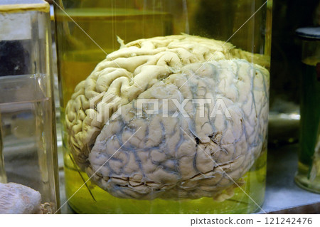 Real human brain. Anatomy of brain, grey substance, grey matter, cortical grey 121242476