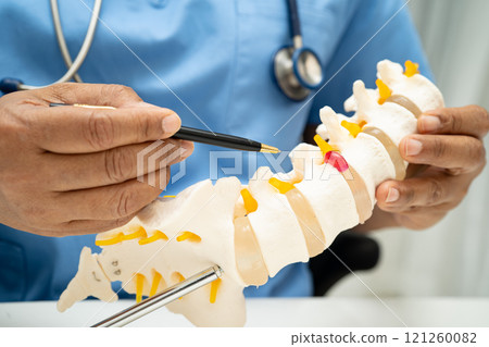 Asian doctor holding spinal nerve and bone model, Lumbar spine displaced herniated disc fragment for treatment medical in the orthopedic department. 121260082