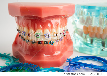 Orthodontic ligatures rings and ties, elastic rubber bands on orthodontic braces, model for dentist studying about dentistry. 121260146