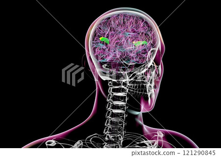 Human brain with highlighted transverse temporal gyri, 3D illustration Human brain with highlighted transverse temporal gyri, 3D illustration 121290845