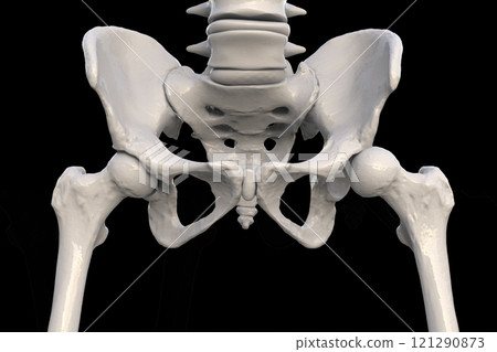 Hip dysplasia, 3D illustration 121290873