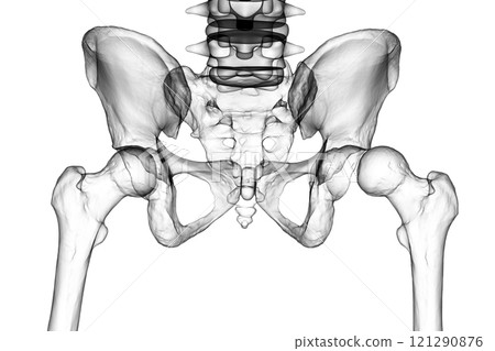 Hip dysplasia, 3D illustration Hip dysplasia, 3D illustration 121290876