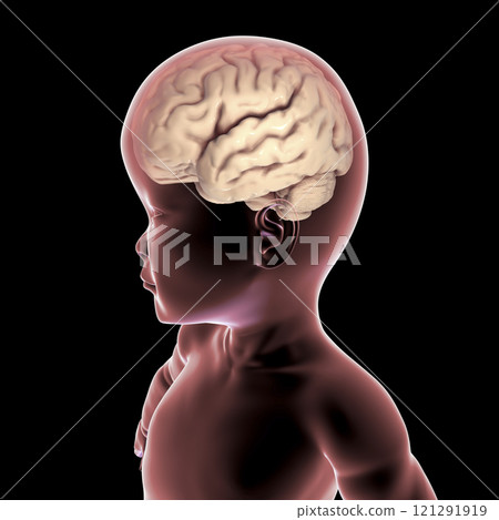 A child with macrocephaly and enlarged brain 121291919