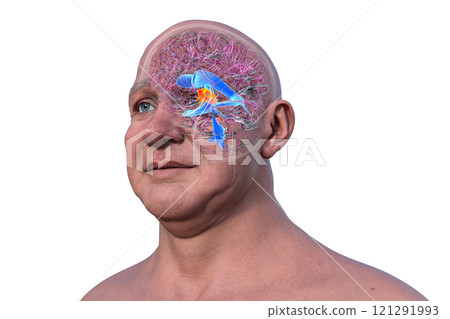 The third brain ventricle, 3D illustration The third brain ventricle, 3D illustration 121291993