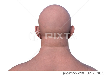 A man's hairless head from back view, 3D illustration A man's hairless head from back view, 3D illustration 121292015