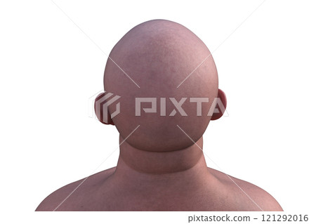 A man's hairless head from back top view, 3D illustration A man's hairless head from back top view, 3D illustration 121292016