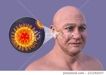 Otitis media in a man, 3D illustration 121292037