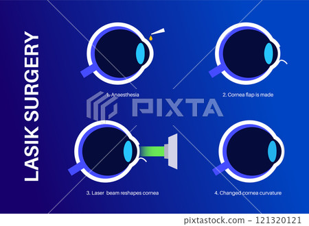 LASIK eye surgery 121320121