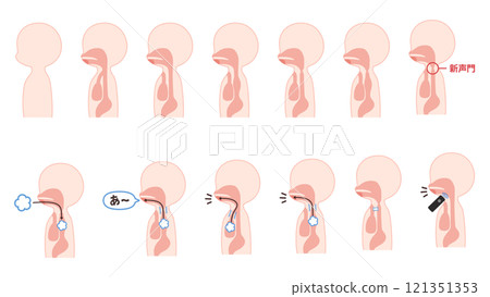 Illustration set of cross sections of the body related to esophageal speech 121351353