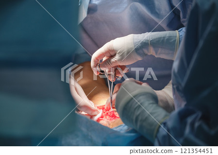 Closeup of doctors hands operating a patient conducting open cut surgery in surgical room. Healthcare and medical intervention concept Closeup of doctors hands operating a patient conducting open cut surgery in surgical room. Healthcare and medical intervention concept 121354451