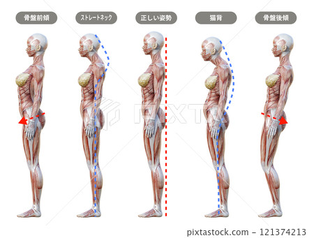 Comparison illustration of female postures (sideways, whole body) Muscle anatomy of pelvic tilt, hunchback, and straight neck 121374213