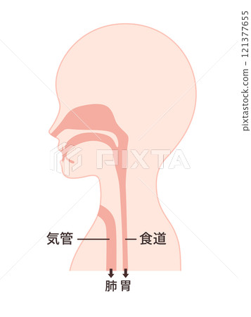 喉癌術後氣管食道圖解 喉癌術後氣管食道圖解 121377655