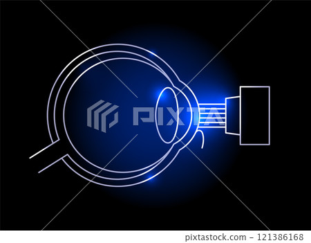 LASIK eye surgery 121386168