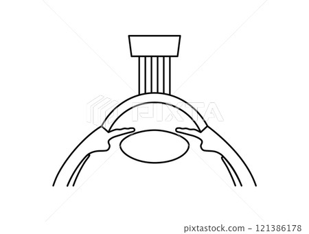 LASIK eye surgery LASIK eye surgery 121386178