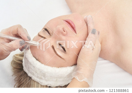 Mature caucasian female receiving cosmetic injection in forehead for skin 121388861