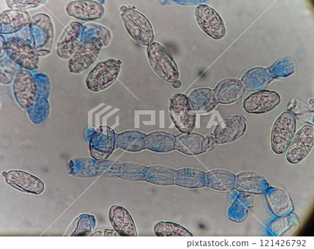 Conidia arranged in a chain 121426792