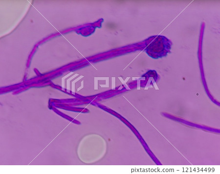 子囊菌分生孢子的形成過程 121434499