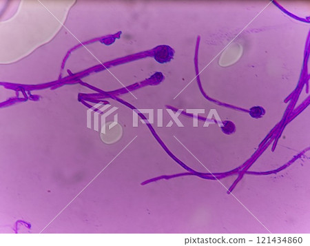 孢子囊形成過程 121434860