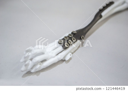 Implants and prostheses printed on 3D printer from biocompatible titanium powder. Plates for correction of deformation for animals. Titanium plates on animal bones printed on 3D printer from plastic. Implants and prostheses printed on 3D printer from biocompatible titanium powder. Plates for correction of deformation for animals. Titanium plates on animal bones printed on 3D printer from plastic. 121446419