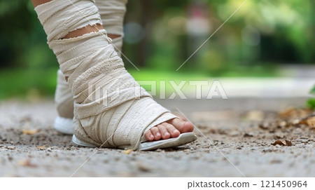 Person with a fractured foot receiving first aid treatment outdoors while walking on a wooded path 121450964