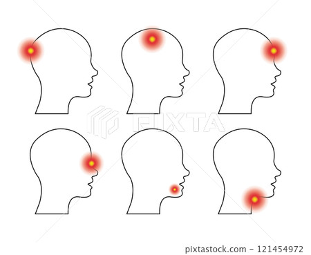 Type of headache and toothache, sore throat. Set of head profile with different pains. Side view. Vector Type of headache and toothache, sore throat. Set of head profile with different pains. Side view. Vector 121454972