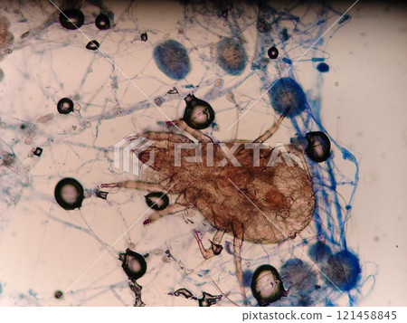 Mites that live in your home 121458845