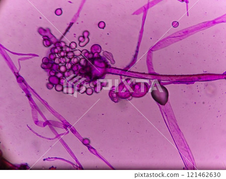 Appearance of sporangium Appearance of sporangium 121462630