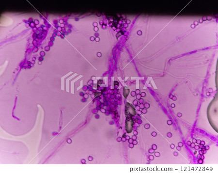 浴室裡黑色黴菌的顯微照片 121472849