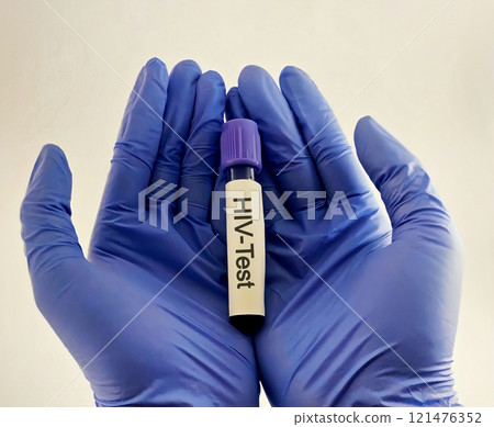 Sample blood collection tube with HIV test label on HIV infection screening test form. 121476352