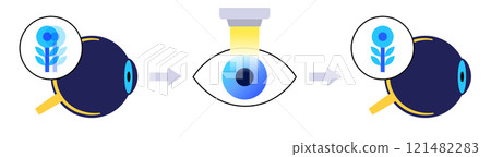 LASIK eye surgery 121482283