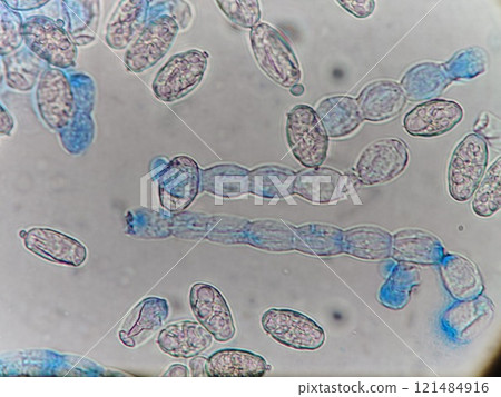 Long chain of spores 121484916