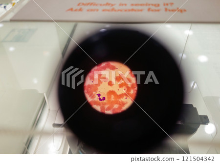 view through the microscope lens of platelet with virus colony. close up 121504342