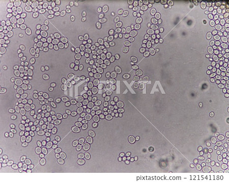 Yeast awakened from freeze-drying 121541180
