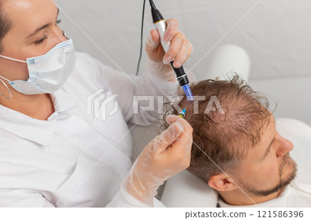 Trichologist doing man improve hair growth procedure, dermapen microneedling, vitamin injections 121586396