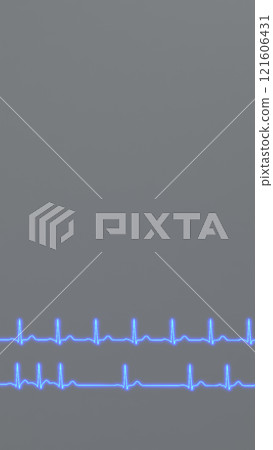 ECG graphs comparison of normal heart rhythm and arrhythmia 121606431