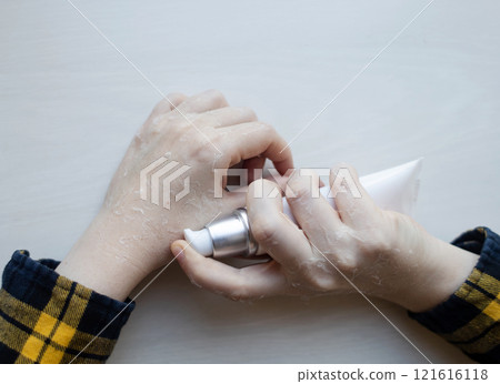 Dry skin on hands. Women's dry hands with peeling, erosions and cracks. Cream for skin dermatological diseases Dry skin on hands. Women's dry hands with peeling, erosions and cracks. Cream for skin dermatological diseases 121616118