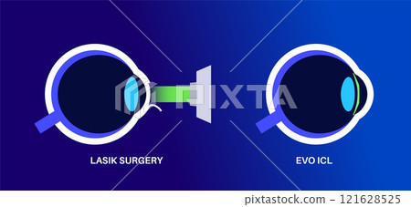 LASIK and ICL EVO LASIK and ICL EVO 121628525
