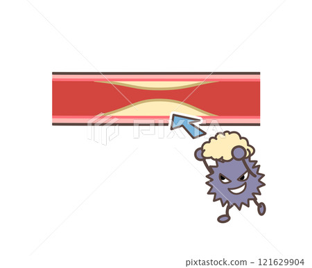 Bad cholesterol and blood vessels 121629904
