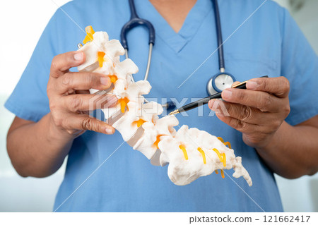 Asian doctor holding spinal nerve and bone model, Lumbar spine displaced herniated disc fragment for treatment medical in the orthopedic department. 121662417